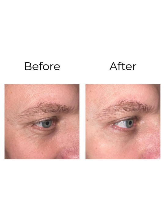 Anti-wrinkle eye contour cream “shock action effect” with LIPHASYN™ 20 ml