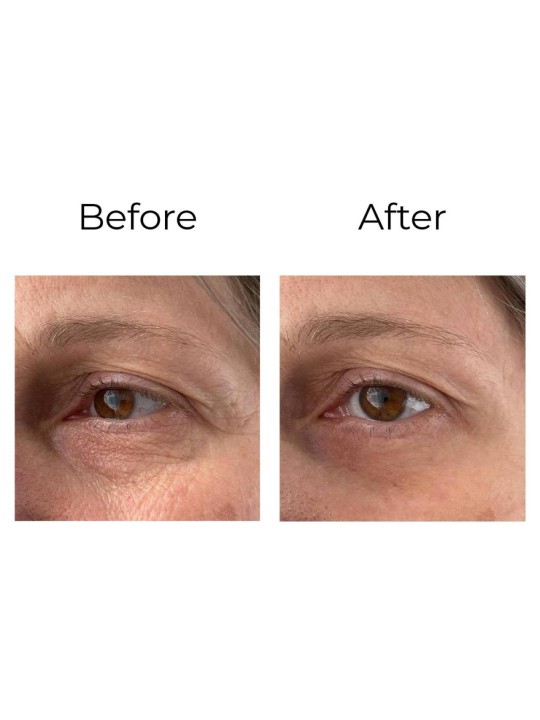 Anti-wrinkle eye contour cream “shock action effect” with LIPHASYN™ 20 ml