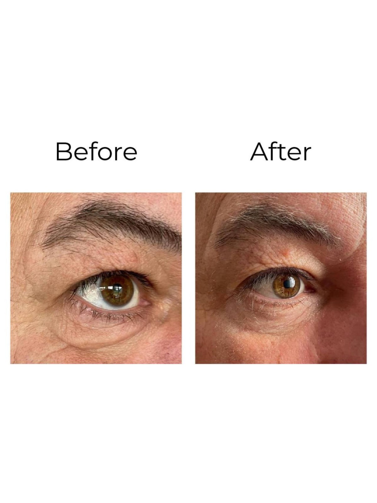 Anti-wrinkle eye contour cream “shock action effect” with LIPHASYN™ 20 ml